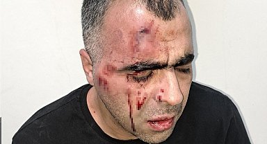 BİGACEM Başkanı Aygül'e saldırıya ilişkin 1'i polis 2 kişi gözaltına alındı