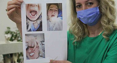 Daha güzel gülmek istedi, yanlış tedavi ile hayatı karardı