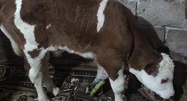 Doğum esnasında ayağı kırıldı, ayağına 6 platin takıldı