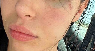 GKRY'da saldırıya uğrayan Karaali'nin duruşması 6 Temmuz'da yapılacak