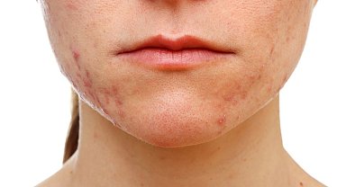 Makyaj yapmadan iyi düşünün