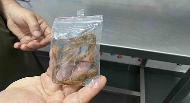 Oyun oynayan kedi 1,5 metrelik kurdele yuttu