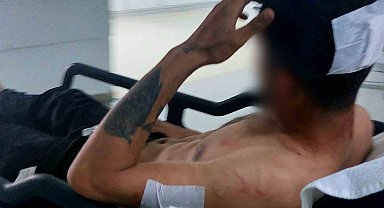 Samsun'da bıçaklı saldırı: 1 yaralı