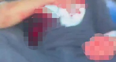 Şanlıurfa'da akraba iki aile arasında silahlı kavga: 1'i ağır 5 yaralı