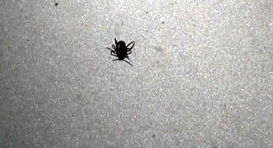 Yozgat'ta son iki ayda 853 kişinin vücudundan kene çıkartıldı