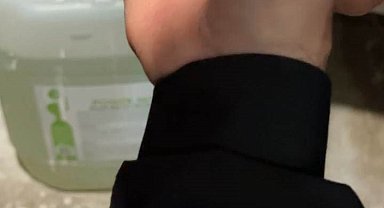 Elazığ'da parmağa sıkışan yüzüğü itfaiye ekipleri çıkardı