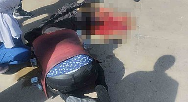 Otobüsün altında kalan hamile kadının bacağı koptu