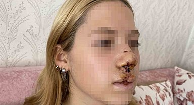 Lise öğrencisi kızın suratına attığı taşla dişlerinin kırılmasına neden olan gencin yargılanmasına başlanıldı