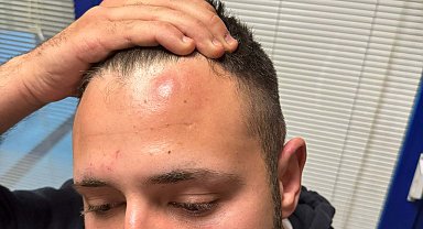 Muayeneye gittiği doktorların saldırdığı iddiası; taraflar birbirinden şikayetçi