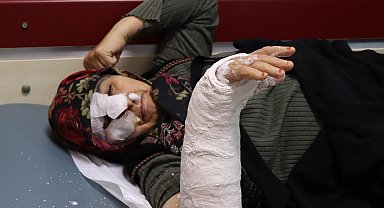 Saldıran sokak köpeklerinden kurtulmaya çalışırken merdivenlerden düşen kadının burnu ve kolu kırıldı