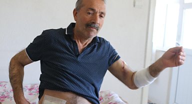 Sokak köpeklerinin saldırısında yaralandı