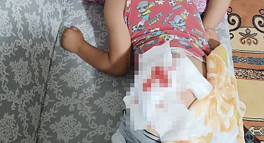 8 yaşındaki Miraç, başıboş köpeğin saldırısında yaralandı