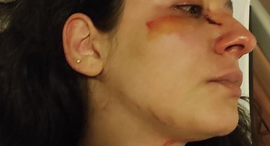 Anne ile kızı, kedilerini öldürdüğünü iddia ettiği baba-kız tarafından darbedildi