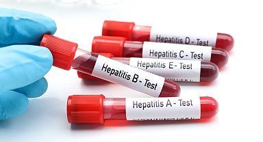 "Birinci derece yakınlarında hepatit olanlar mutlaka taramadan geçmeli"