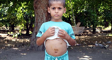 Sokak köpeklerinin saldırısında ölümden dönen 5 yaşındaki Abbas: Çok korktum