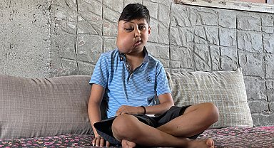 Yüzündeki kitle her geçen gün büyüyen ve gözünü kaybeden Enes, sağlığına kavuşmak istiyor