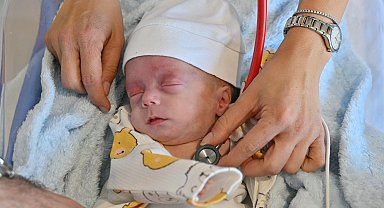 980 gram doğan Işık bebeğe anjiyo, literatüre geçti