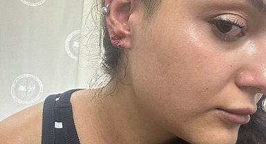 Haber için giden DHA muhabirine saldırı