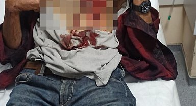 Hayvanlarını otlatırken domuz saldırısında yaralandı