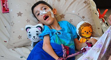 Hidrosefali hastası Osmancan, yaşından çok ameliyat geçirdi