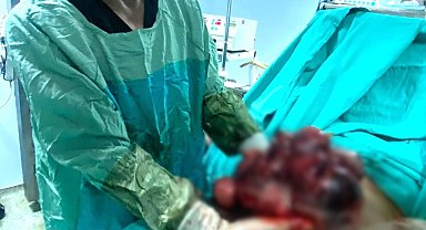 Yıllarca karnındaki 10 kiloluk kitleyle yaşamış