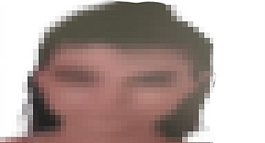 Eski nişanlısının kaçırıp, ormanda vurduğu Elif'in diğer bacağı da kesildi