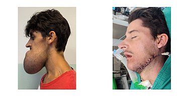 Gönüllü Türk hekimler, Kosova'ya gidip 22 hastayı 53 ayrı ameliyatla sağlığına kavuşturdu