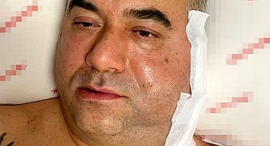 Pilotun ameliyatta ölümünde, 'doktor ihmali' iddiası