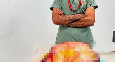 'Karın ağrısı' şikayetiyle gittiği hastanede karnından 26 kiloluk tümör çıktı