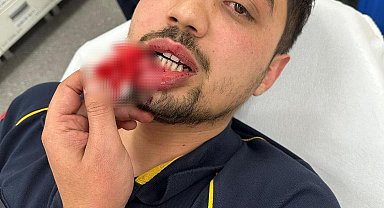 Baba ile oğlu, hasta taşıyan ambulansın önünü kesip sürücüyü darbetti