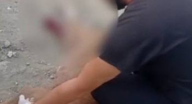 İstanbul- Esenyurt'ta aracın çarptığı yaralı köpek tedavi altına alındı