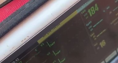 İstanbul - Halit Bayşu'nun EKG cihazında nabzının attığı görüntüler ortaya çıktı