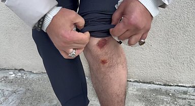 İstanbul- Esenyurt'ta sokakta beslenen köpekler yolda geçenlere saldırdı