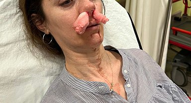 Kendisini eşinin sevgilisi zanneden kadın tarafından darbedildi