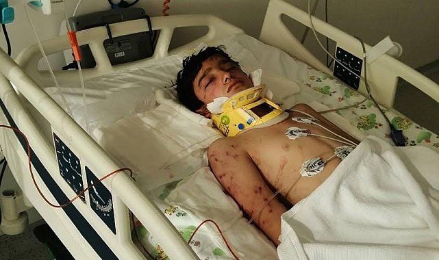 Sokak köpeklerinin saldırdığı Hayrettin'in yoğun bakımda tedavisi sürüyor