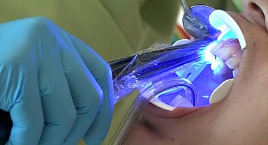 'Beyazlatma işleminde yanlış uygulama diş kaybına neden olabilir'