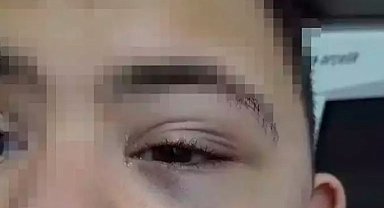 Down sendromlu öğrenciye şiddet davasında öğretmene indirimli 12 bin lira ceza