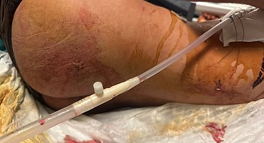 İstanbul- Fatih'te 5 kişi yolda karşılaştığı husumetlisini sopalarla darbedip bıçakladı