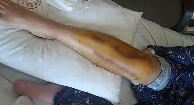 İstanbul - Gittiği haciz işleminde saldırıya uğrayan avukat 3 ameliyat geçirdi