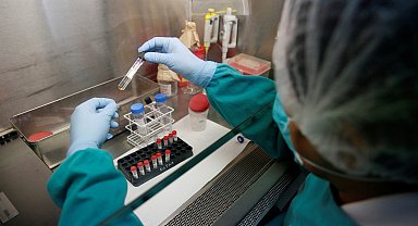 ABD'de tüberküloz vakalarında artış sürüyor