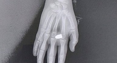 Eline yorgun mermi düşen çocuk yaralandı