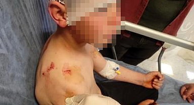 Köpeğin saldırdığı 9 yaşındaki çocuk yaralandı