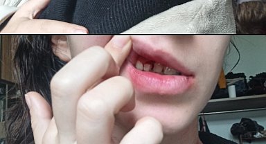 Parkta genç kıza kafa atıp, boğazını sıkan şüpheliye 3 ay sonra elektronik kelepçe