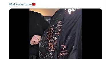 Yerlikaya: Saraçhane'de bu gece yapılan gösterilerde bir polis memurumuza asit atıldı