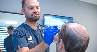 'Saç dökülmesi ilerlediyse, ilaçlar etkili olmaz'