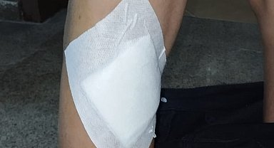 Başıboş köpekler 2 çocuğu ısırdı