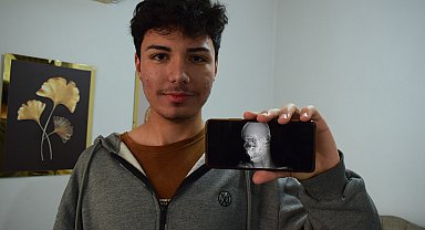 Yusuf, başındaki yorgun mermi nedeniyle 1,5 yıldır her gün ölüm korkusu yaşıyor