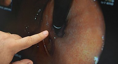 'Bağırsak hastalıkları doğru tedavi ve beslenme ile kontrol altına alınabilir'