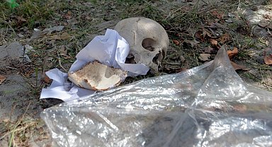 Çöpten kağıda sarılı insan kafatası çıktı