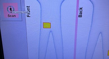 İstanbul- İstanbul Havalimanı'nda 3 kadının cinsel organlarında 6 kilo altın ele geçirildi